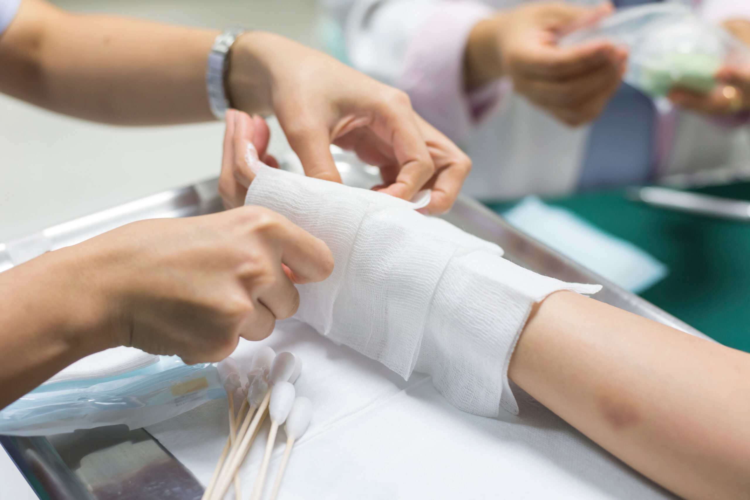 Alexandria Burn Injury Lawyer